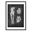 Load image into Gallery viewer, Knee anatomy art print