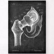 Laden Sie das Bild in den Galerie-Viewer, Hip joint anatomy poster
