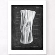 Load image into Gallery viewer, Popliteal fossa - Chalkboard