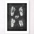 Laden Sie das Bild in den Galerie-Viewer, Knie Anatomie II - Chalkboard