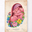 Charger l'image dans la galerie, Fetus in a womb anatomy poster