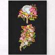 Load image into Gallery viewer, Herniated disc anatomy art print