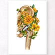 Load image into Gallery viewer, Hip joint replacement poster