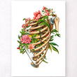 Load image into Gallery viewer, Rib fracture anatomy poster