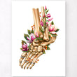Load image into Gallery viewer, Ankle fracture poster