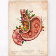 Load image into Gallery viewer, Gastric ulcers anatomy poster