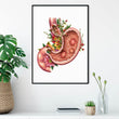 Charger l'image dans la galerie, Stomach ulcers anatomy poster