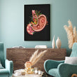 Load image into Gallery viewer, stomach ulcers anatomy print
