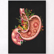 Load image into Gallery viewer, gastric ulcers anatomy poster