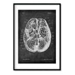 Load image into Gallery viewer, brain anatomy art print in chalkboard style by codex anatomicus