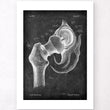 Laden Sie das Bild in den Galerie-Viewer, Hip joint and femur heaf anatomy print