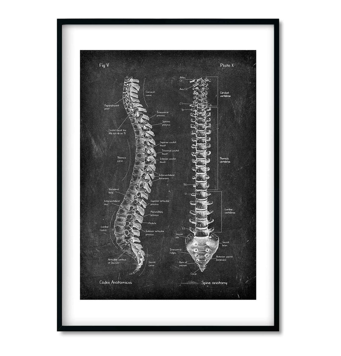 Spine And Back Muscles Chalkboard Anatomy Art Set Of 3 Codex Anatomicus 1844