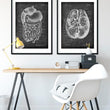 Load image into Gallery viewer, Digestive system anatomy art - Chalkboard