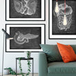 Load image into Gallery viewer, Pancreas anatomy - Chalkboard