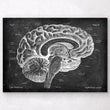 Load image into Gallery viewer, Brain anatomy poster