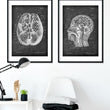 Load image into Gallery viewer, Brain anatomy