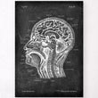Load image into Gallery viewer, Head section and brain anatomy chalkboard poster