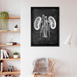 Load image into Gallery viewer, Kidney anatomy poster