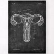 Load image into Gallery viewer, Uterus anatomy poster