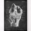 Load image into Gallery viewer, Knee anatomy art print