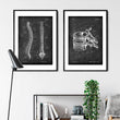 Load image into Gallery viewer, Spine anatomy poster