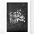 Load image into Gallery viewer, Thoracic vertebrae - Chalkboard