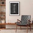 Load image into Gallery viewer, Tibia and fibula bone anatomy chart