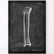 Load image into Gallery viewer, Tibia and fibula anatomy poster