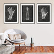 Charger l'image dans la galerie, Ulna et radius - Chalkboard