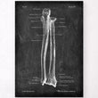 Charger l'image dans la galerie, Ulna et radius - Chalkboard