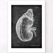 Load image into Gallery viewer, Kidney and adrenal gland labeled poster