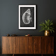 Load image into Gallery viewer, Kidney anatomy poster