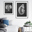 Load image into Gallery viewer, Kidney poster