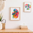 Load image into Gallery viewer, Nephrology poster