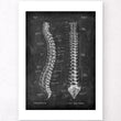 Load image into Gallery viewer, Spine anatomy - Chalkboard