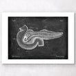 Load image into Gallery viewer, Pancreas anatomy - Chalkboard