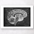 Load image into Gallery viewer, Sagittal brain anatomy - Chalkboard