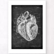 Laden Sie das Bild in den Galerie-Viewer, Dissected heart anatomy print