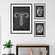 Load image into Gallery viewer, Anatomical uterus poster