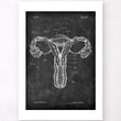 Load image into Gallery viewer, Uterus anatomy - Chalkboard