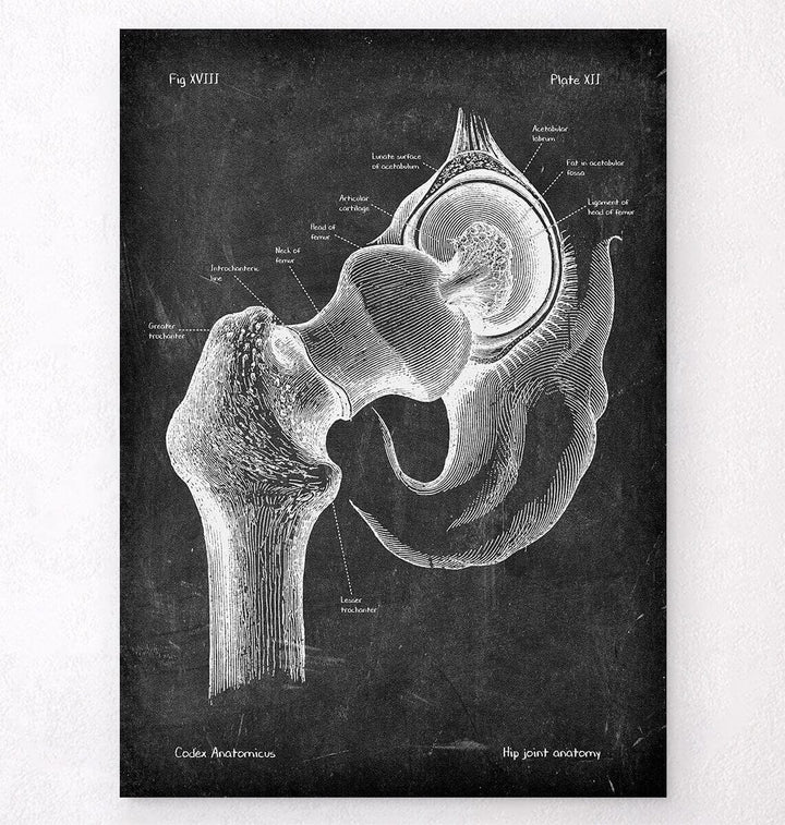 Hip joint anatomy poster