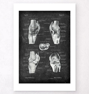 Knee anatomy chart - Chalkboard