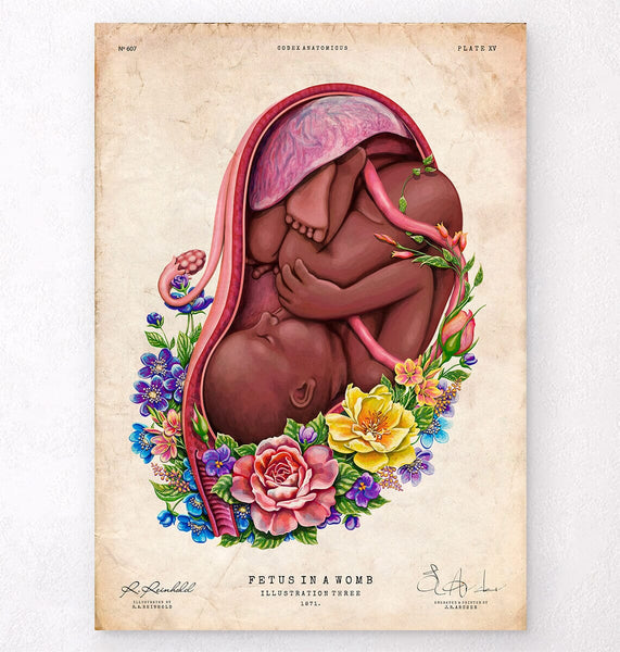 LPA607_grande.jpg?v=1695984295