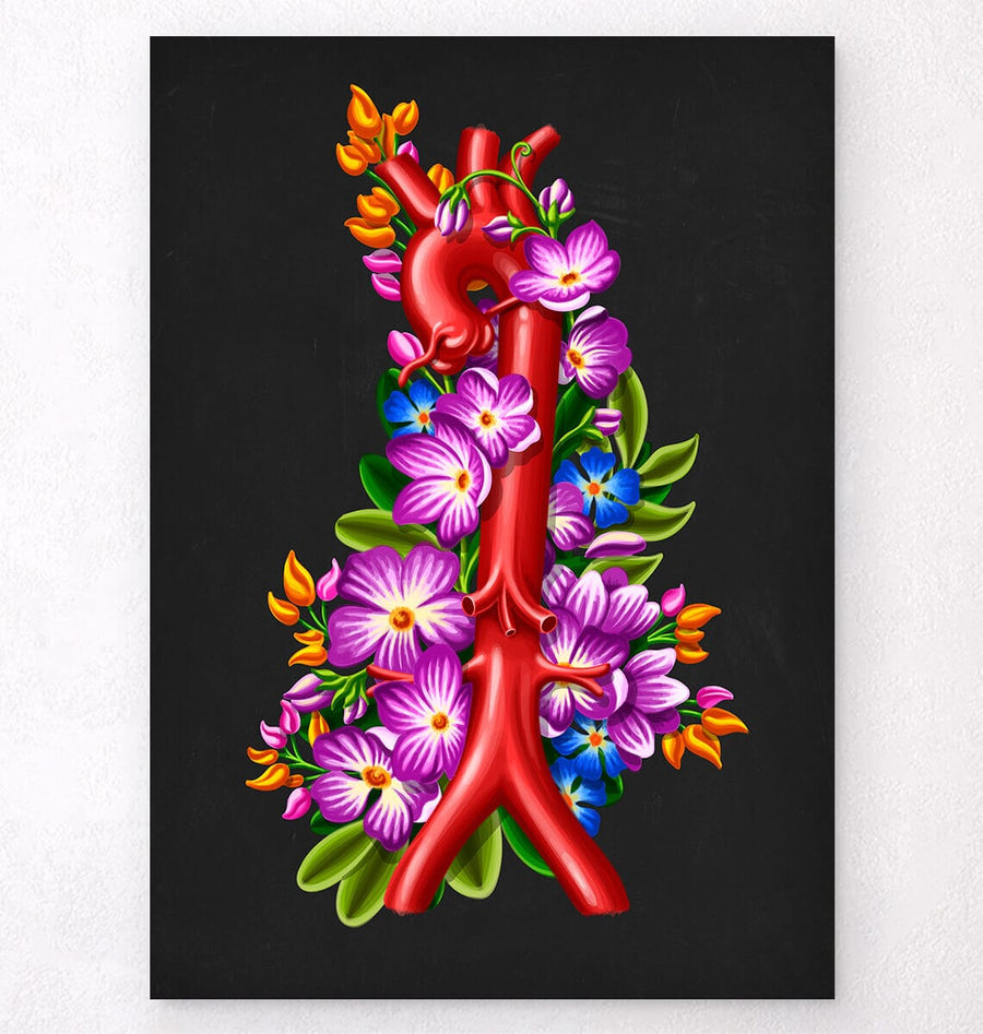 Aorta anatomy poster