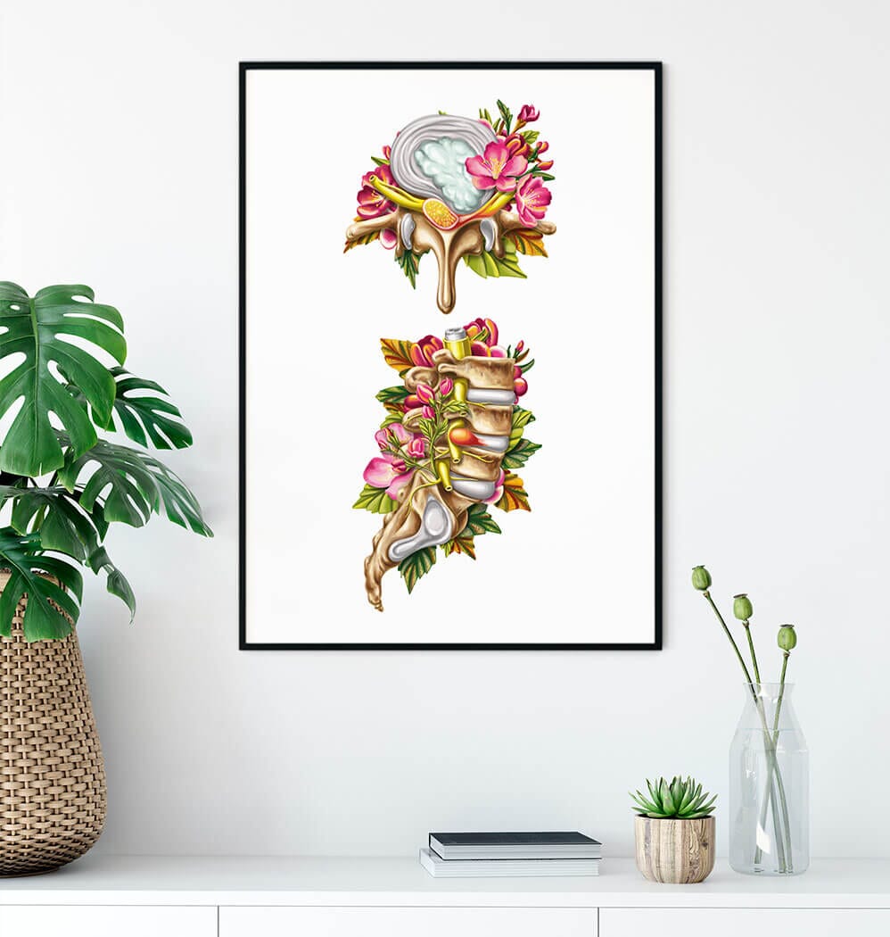 Floral herniated disc anatomy art print – Codex Anatomicus