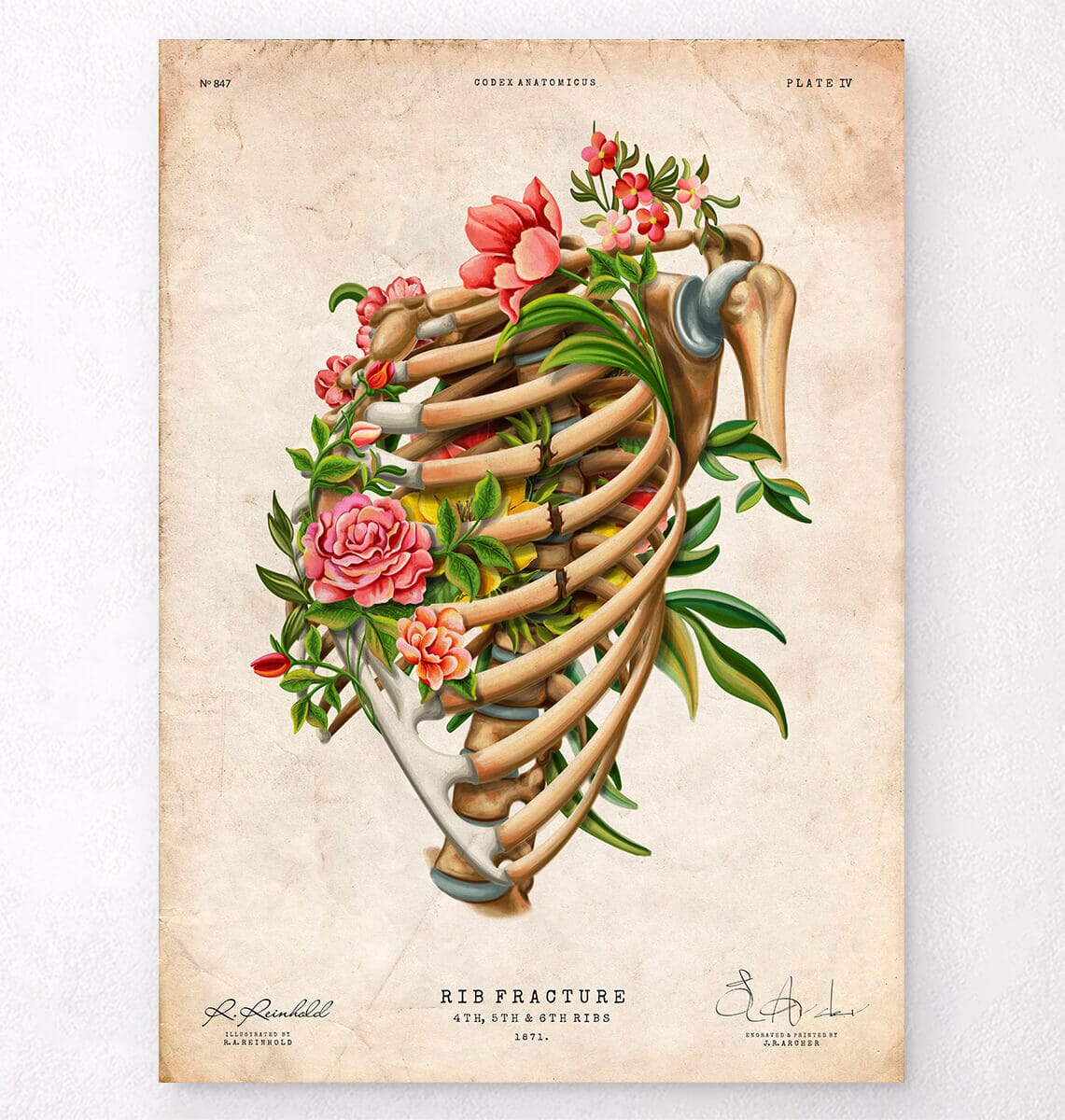 Rib fracture art print - Floral - Vintage - Codex Anatomicus