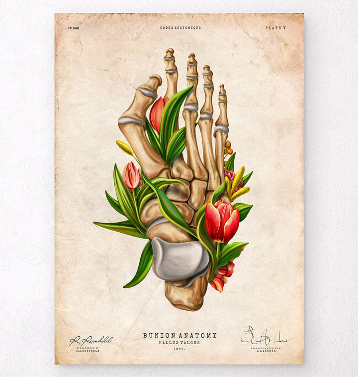 hallux valgus vintage anatomy poster