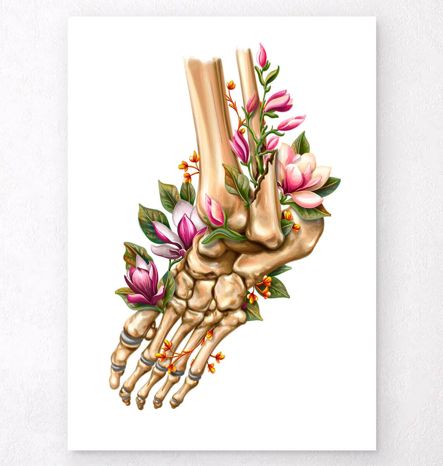 Ankle fracture poster