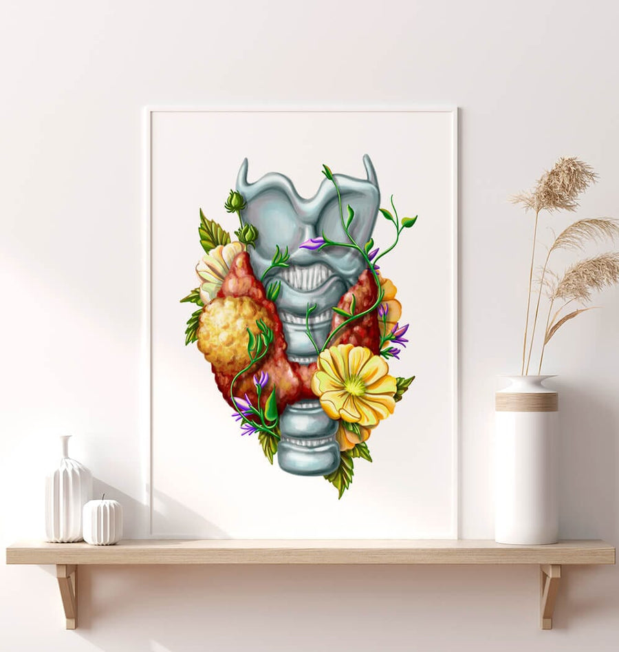 Thyroid adenoma art print