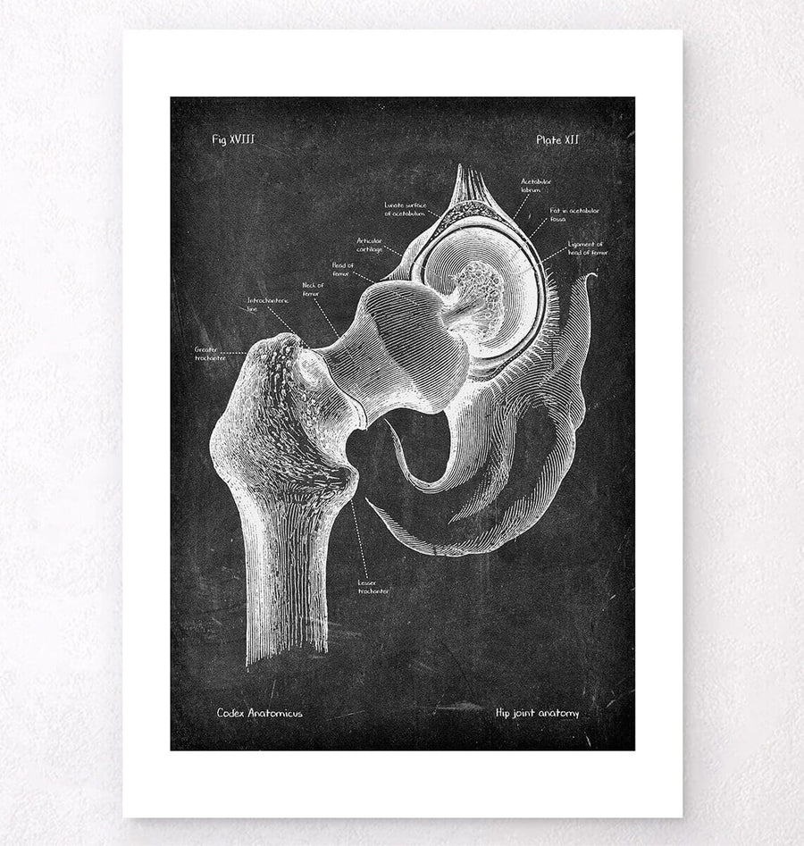 Hip joint and femur heaf anatomy print